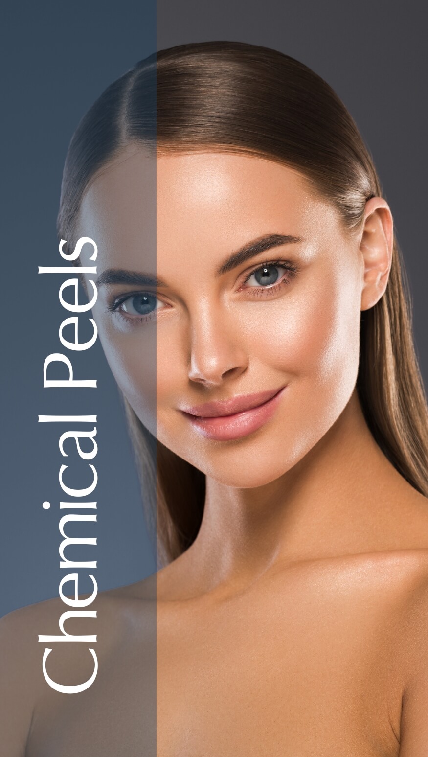 A close-up portrait of a woman with smooth, glowing skin, promoting the benefits of chemical peels. The image features the text "Chemical Peels" on the left side, highlighting the skincare treatment's effectiveness in enhancing skin texture and tone. The background showcases a gradient of blue and gray, creating a modern and inviting aesthetic. This visual representation aims to attract individuals seeking skincare solutions for a rejuvenated appearance.